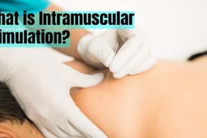 What is Intramuscular Stimulation (IMS) Physiotherapy Treatment?