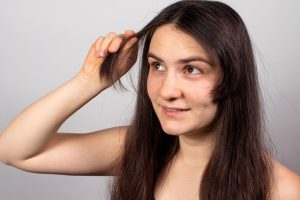 How Does PRP Treatment Work for Hair Growth?