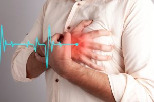 What Should You Do if You Witness a Heart Attack?
