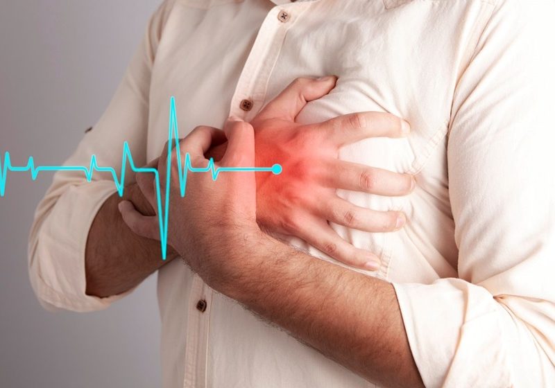 What Should You Do if You Witness a Heart Attack?