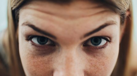 Can You Lift Upper Eyelids without Surgery?