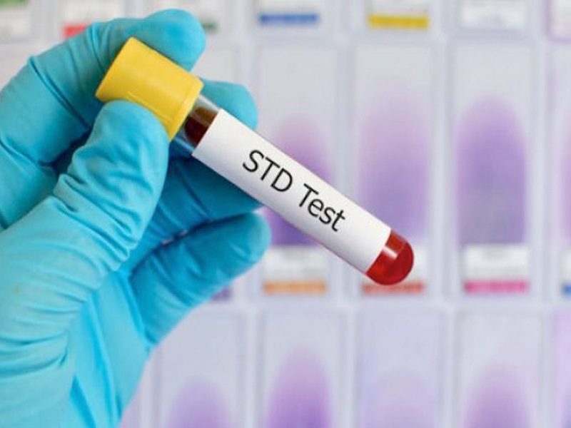 Who Should Consider STD Testing and How Often?