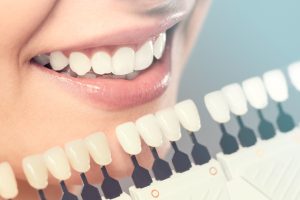 5 Common Myths About Cosmetic Dentistry That You Should Never Believe