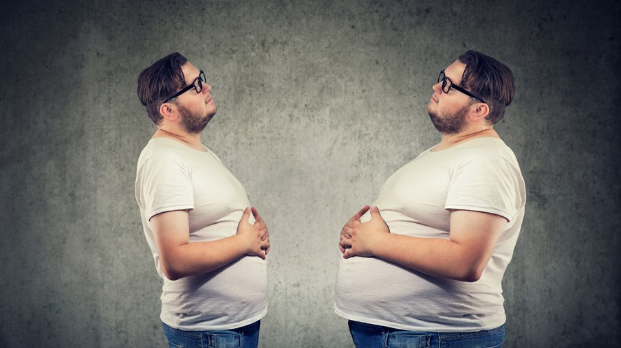 A Comprehensive Guide to Gastric Sleeve Surgery