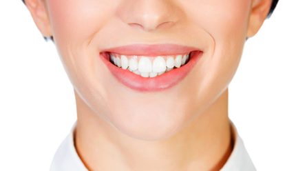 Home teeth-whitening systems in San Jose: Check this review
