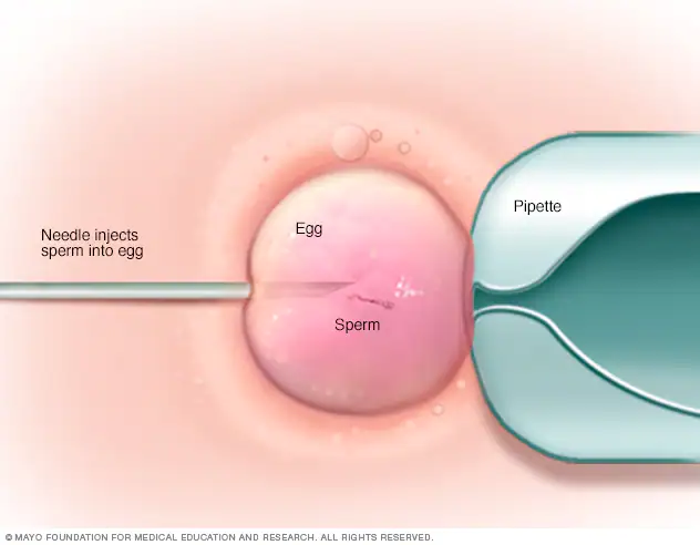 Procedures Performed by Infertility Specialists