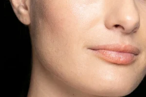 Non-surgical Rhinoplasty: How It Works and Benefits