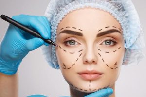 Top 5 Questions To Ask Before An Aesthetic Procedure