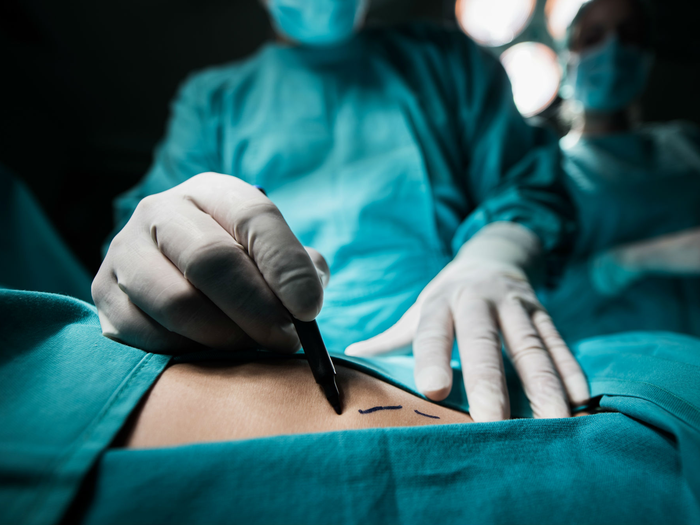The Pros and Cons of Plastic Surgery: What to Consider Before Going Under the Knife