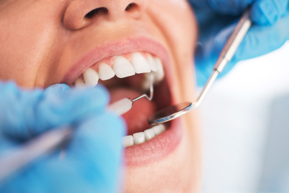 The Impact of Diet on Dental Health: Tips from a General Dentist