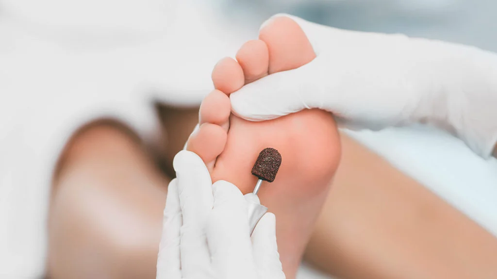 Common foot problems treated by a Podiatrist