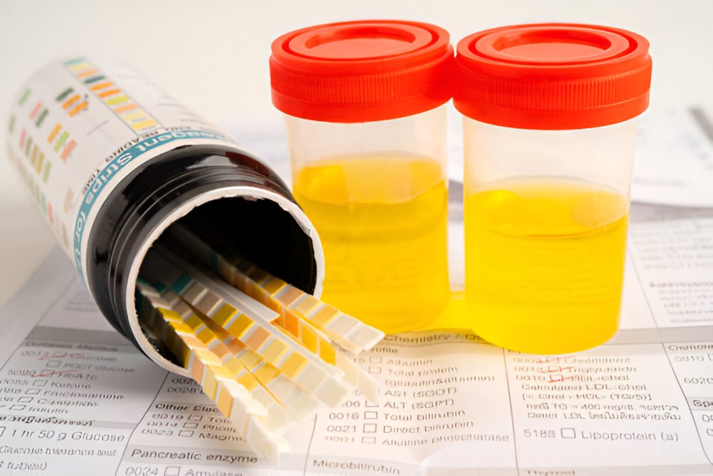 Analyzing Cost-Saving Benefits of Drug Testing at Work