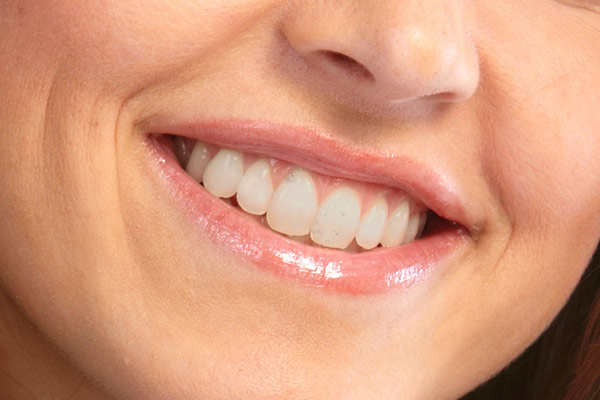 cosmetic dentistry