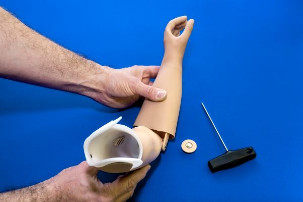 Transradial Prostheses