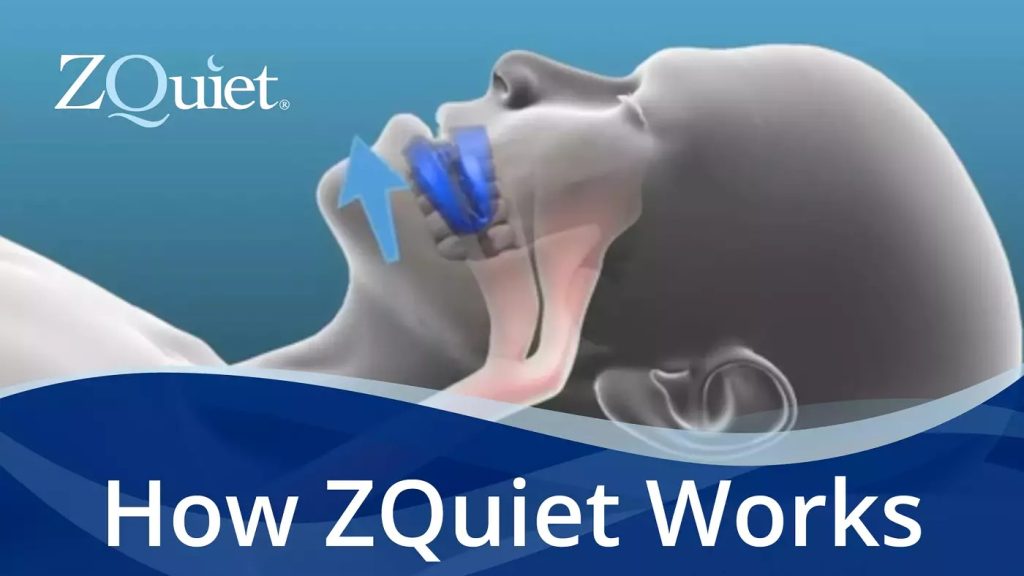 The ZQuiet Become A Game Changer for Snoring Relief